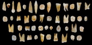 47 early AMHs teeth-fossil-Fuyan-China